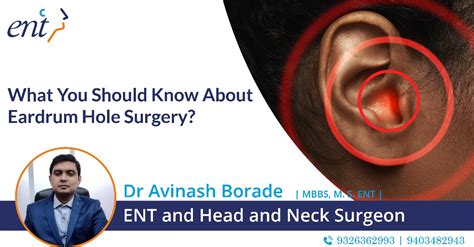 Eardrum Hole Surgery: What You Need To Know