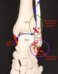 High Ankle Ligaments