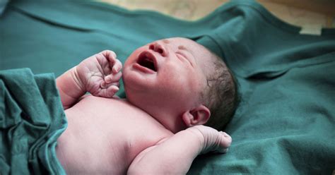 Baby's geboren via keizersnede hebben later meer gezondheidsproblemen ...