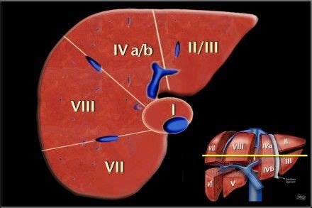 Anatomy of the liver segments | Liver anatomy, Medical radiography, Medical ultrasound