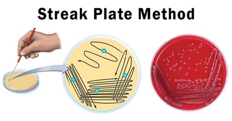 Streak Plate Method- Principle, Methods, Significance, Limitations