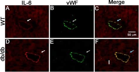 Anti-Von Willebrand Factor antibody (ab6994) | Abcam