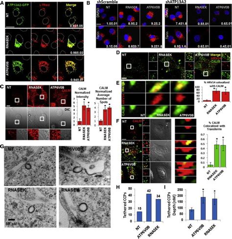 The V-ATPase and P-ATPase Function Redundantly to Regulate ...