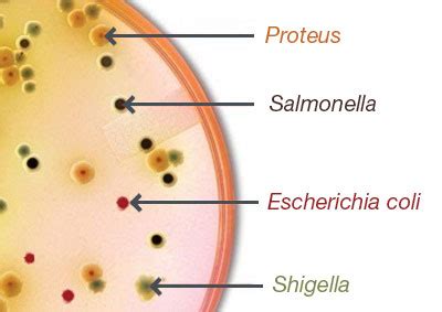 Salmonella On Ss Agar / Remel Salmonella Shigella Agar - • selective ...