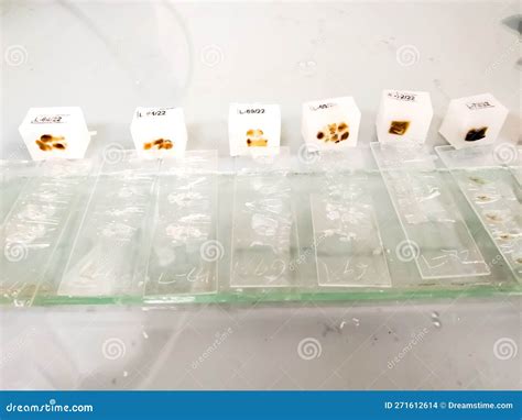 Histology Paraffin Embedded Tissue Samples into a Slide Stock Photo - Image of medical ...