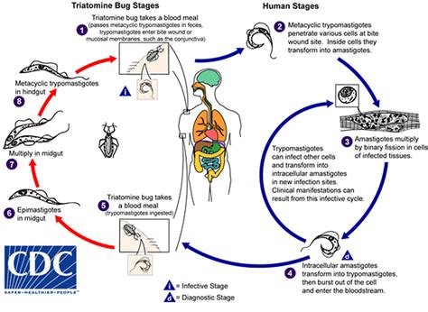 Chagas Disease - Parasite, Symptoms, Complications, Treatment