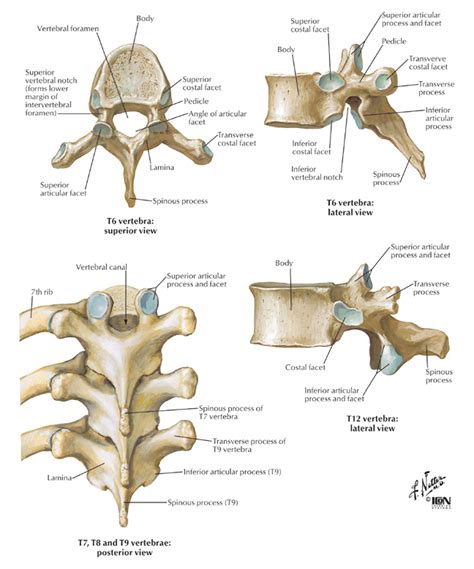 Spine & Back:Bones:Thoracic vertebrae | RANZCRPart1 Wiki | FANDOM ...