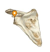 Supraglenoid tubercle - e-Anatomy - IMAIOS