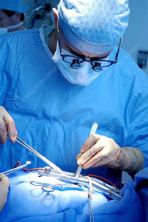 Heart surgery - Stock Image - M560/0499 - Science Photo Library