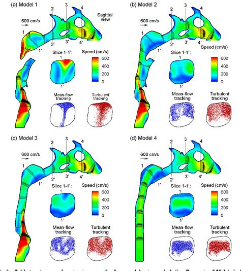 Figure 5 from Effect of Laryngopharyngeal Anatomy on Expiratory Airflow and Submicrometer ...