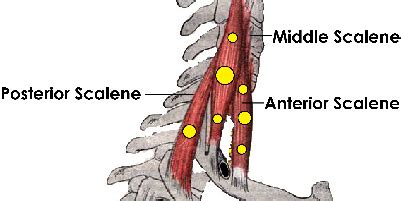 Scalene Muscles Trigger Points