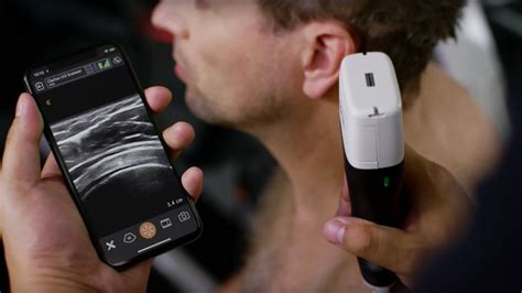 Thank you - Portable Ultrasound Scanner - Clarius Mobile Health