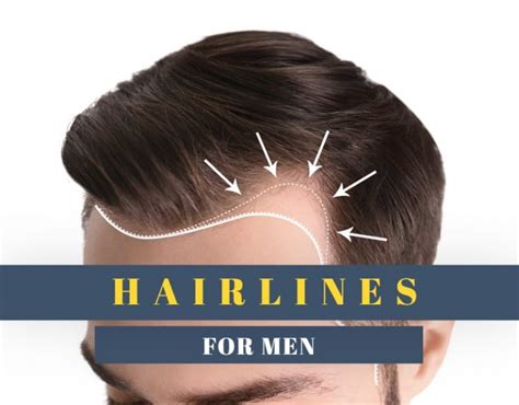 6 Types of Hairlines for Men – Cool Men's Hair