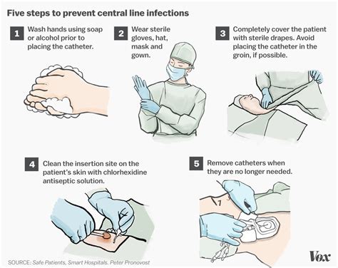 Hospitals Ignore Increasing Rate of Central Line Infections