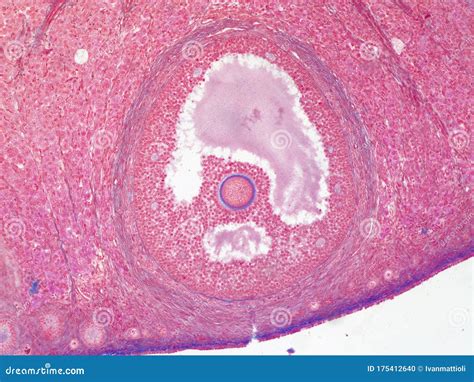 Follicle and Egg Cell in Human Ovary Under Microscope Stock Photo - Image of sample, research ...