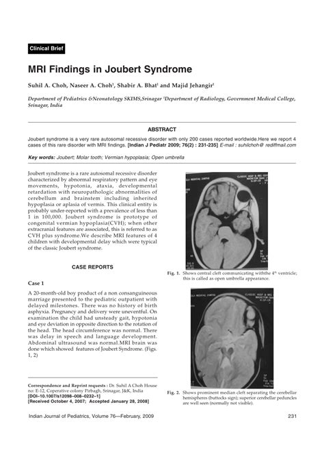 (PDF) MRI findings in Joubert syndrome