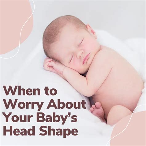 When to Worry About Your Baby’s Head Shape - Noodle Soup