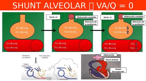 EXPLICACIÓN DE SHUNT ALVEOLAR | Esquemas y mapas conceptuales de Fisiología - Docsity