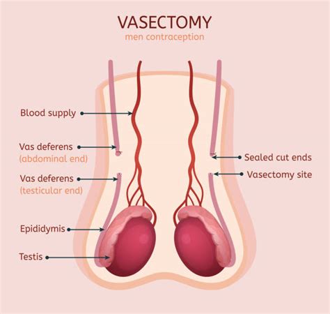 Pics Of Male Reproductive System Diagram Stock Photos, Pictures ...