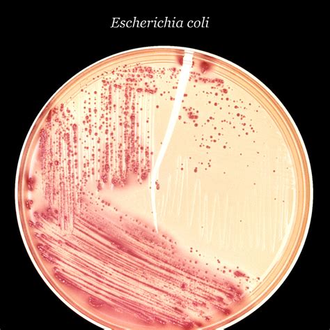 Free picture: inoculated, macconkey, agar, culture, plate, colonial ...