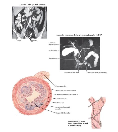 CT and MRCP Showing Appendix, Gallbladder, and Ducts; Nerve Branches of ...