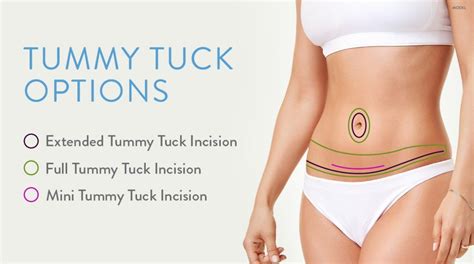 Mini Tummy Tuck vs. Full Tummy Tuck: Choosing the Right Procedure – Dermatology Associates of ...