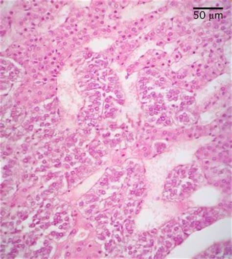 Adrenal Gland Histology - Adrenal medulla - histology slide