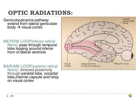 Optic radiations Meyers loop and Barmus loop | Human anatomy and physiology, Anatomy and ...