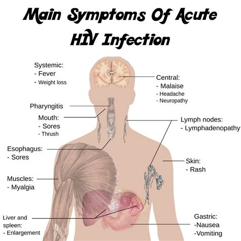 Main Symptoms of HIV infection | Hiv infection, Aids symptoms, Hiv