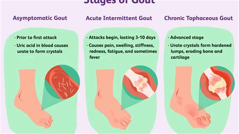 What Is Uric Acid In The Body : What Is Uric Acid High Uric Acid Level ...