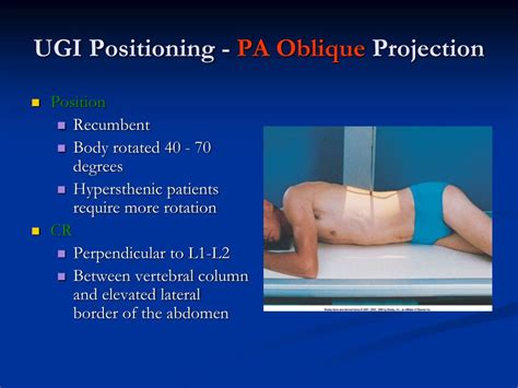 Oblique Chest X Ray Positioning