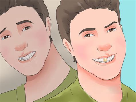 How to Avoid Dental Crown Problems: 9 Steps (with Pictures)