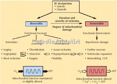 Ischemia Myocardial ischemia(MI) ECG and effects of ischemia - || MedicScientist :: Total Health ...