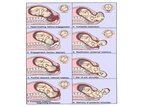 Mechanisms Of Labor