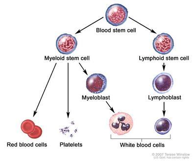 Multiple Myeloma - Physiopedia