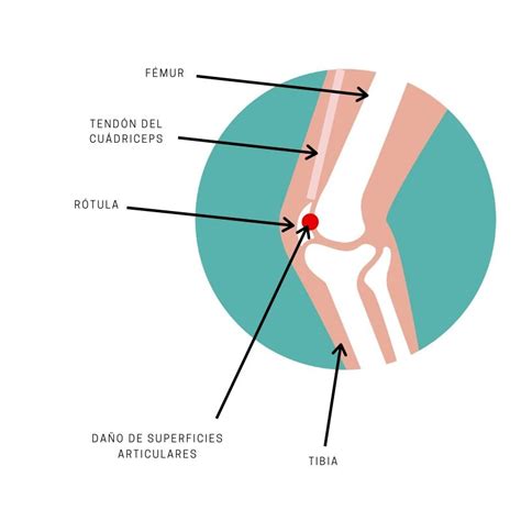 rodilla - Clinica Adler