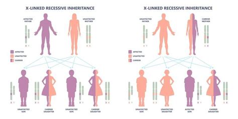 x-linked-recessive-inheritance-duchenne-muscular-dystrophy-treatment-propel-physiotherapy ...