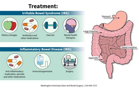 Inflammatory Bowel Disease or Irritable Bowel Syndrome? | Department of Surgery | Washington ...