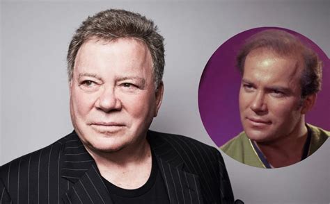 Is William Shatner Bald? | lupon.gov.ph