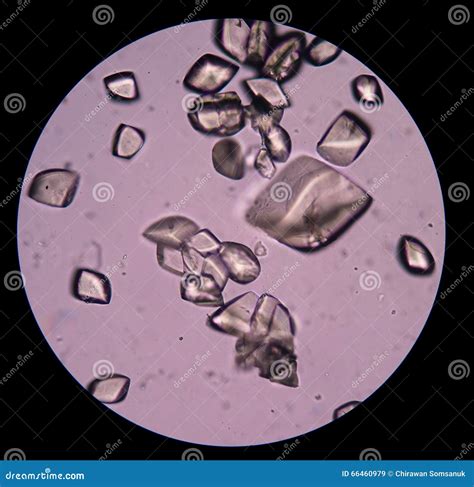 Uric Acid Crystals In Urine Microscopic Stock Photography | CartoonDealer.com #135005912