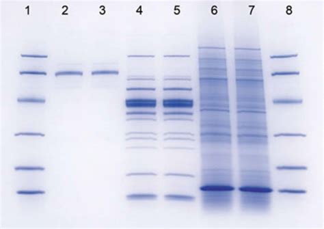 How can gel electrophoresis be used to detect mutations? | Socratic