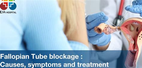 Fallopian Tube Blockage: Causes, Symptoms and Treatment - Eva Hospital