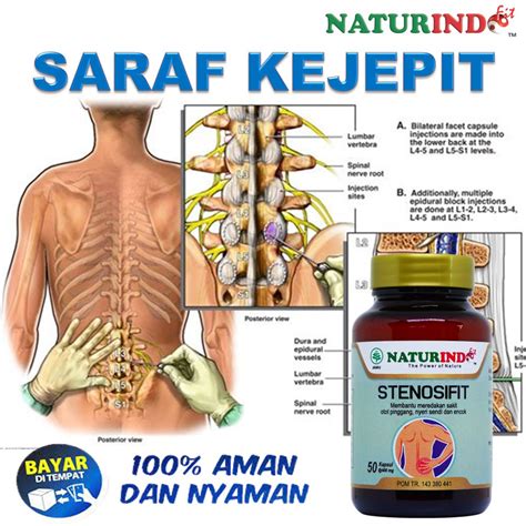 Jual Obat Saraf Kejepit Pinggang Dan Kaki Sakit Pinggang Sakit Punggung Saraf Terjepit Syaraf ...