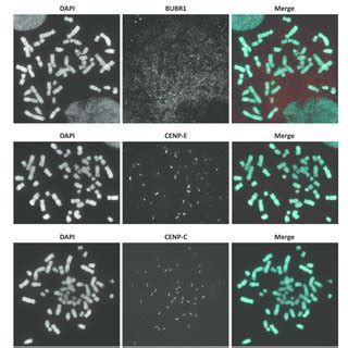 Active centromere antibody screening on methanol-acetic acid fixed... | Download Scientific Diagram