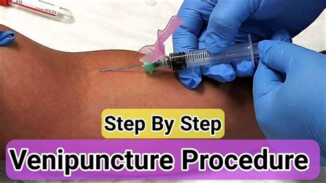 Venipuncture Procedure Step By Step - How to take Blood - Phlebotomy - YouTube