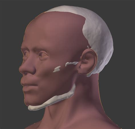 ATOR: Forensic facial reconstruction of a living individual using open-source software (blind test)