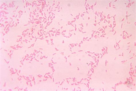 Public Domain Picture | This micrograph depicts Bacteroides fragilis ss ...