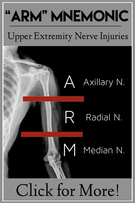 "ARM" Mnemonic for Humerus Fracture Nerve Injuries: Skeletal System and Ortho Nursing Notes ...