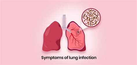 Symptoms of lung infection that should never be avoided | Dr. Arvind Kumar