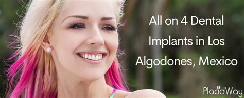 Affordable All on 4 Dental Implants in Los Algodones, Mexico